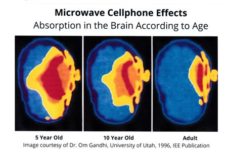 EMF radiation is able to penetrate 3 times more brain tissue in babies as compared to adults